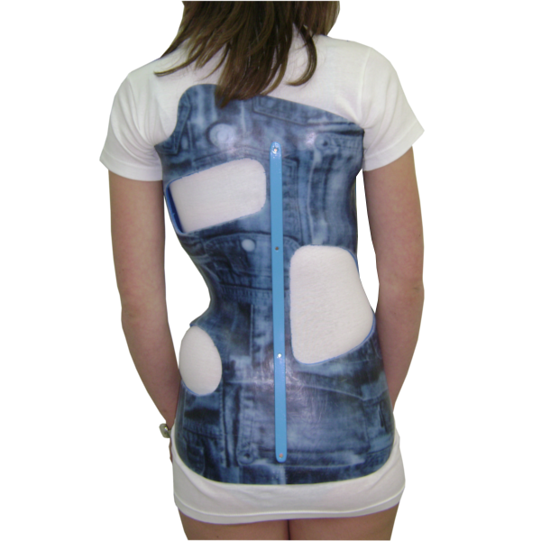 Corset Cheneau / CTM Corsets de traitement scoliose NEUT — free download